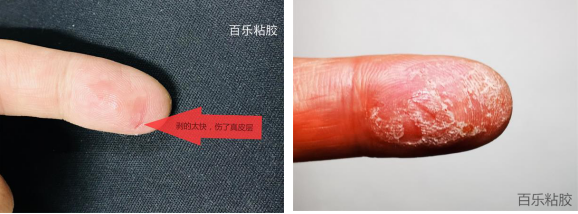 502胶水把手黏住了干了怎么办