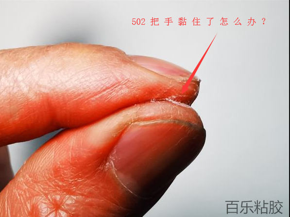 502把手黏住了有毒吗怎么办