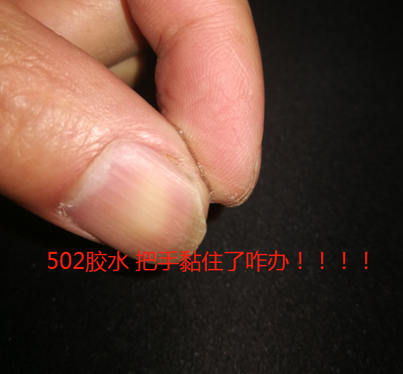 502把手黏住怎么办找百乐粘胶