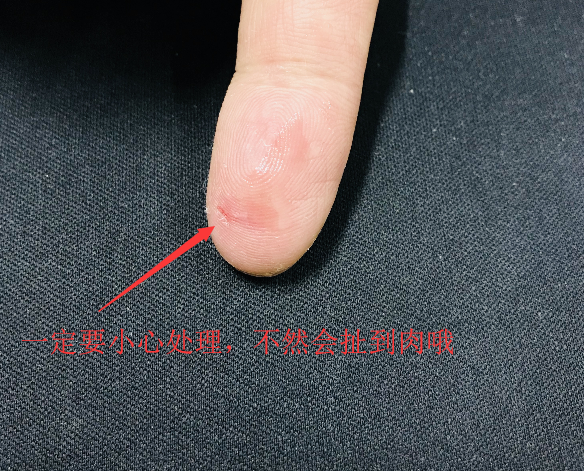 502胶水粘手怎么处理